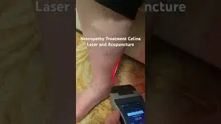 Neuropathy Treatment Celina: Chiropractor - Laser - Acupuncture