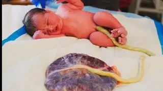 Placenta or baby ke bich attachments #placenta #baby #attachmentstyles #anatomy #3danimation #love 