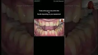 ALERT: Dentist Warns: 'No-Prep' Veneers Could Damage Your Child's Smile!