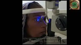 Tonometry Tips - GLADv (Glaucoma Learning And Diagnostic Videos) #1 -  by Dr Kirti Singh