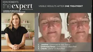 Manual Lymphatic Drainage Method with MYSKINBUDDY By The Expert Esthetician Erin Roberts