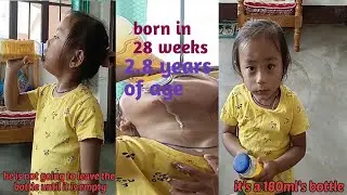 preemie baby | preemie baby development