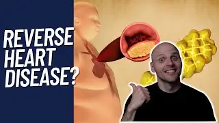 Can you reverse heart disease with diet? (SCIENCE explained!)