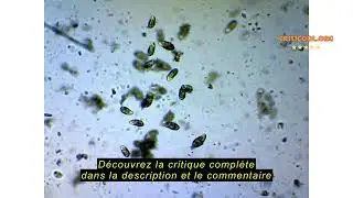 Avis sur la AmScope B120C-E1 LED Digital Binocular Microscope 40x -2500X Magnification with 3D Turnt