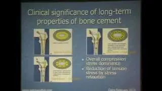 Bone cement and cementing techniques - Prof. Foad Zamel By D. Mohamed Abo Elsoaud