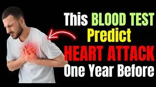 This One Blood Test Predicts Heart Attack Years Early (Force Your Doctor To Do This Test)