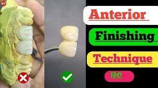 Anterior Finishing Techniques|| Ceramic finishing videos| Anterior ceramic video| Anterior Anatomy| 