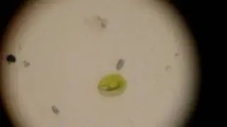 Phacus (a euglenoid)
