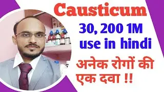 Causticum 30 200 1M use in hindi /Causticum homeopathic medicine use & symptoms /causticum for warts