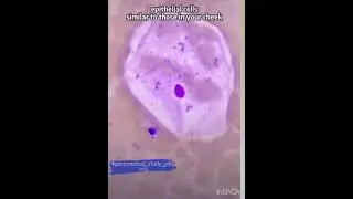Period blood under microscope ##woman menstral cycle ##test##lab
