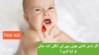 First aid for nail/Finger Cut of your baby's Nails| Nail-bed Injury in infants
