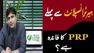 PRP Before And After Hair | Hair transplant results in Pakistan | dr Zunair Munir