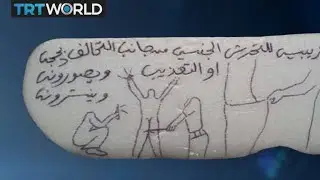 The War in Yemen: Detainee abuse alleged at UAE-controlled prison