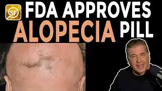 Alopecia Breakthrough: FDA Approves First Pill To Treat Hair Loss Disorder