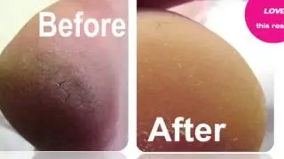 Best Pedicure Before and After - Elim Spa Products