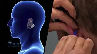 IHS Bridge Method of Action Split Screen