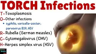 TORCH Infections: Causes, Risks, Symptoms, Diagnosis & Treatment | TORCH Syndrome - Obstetrics