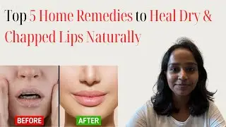 Top 5 Home Remedies to Heal Dry & Chapped Lips Naturally #HealDryLips
