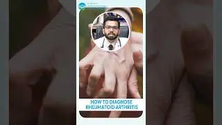 How to diagnose Rheumatoid Arthritis? रूमेटॉइड आर्थराइटिस का निदान कैसे करें?