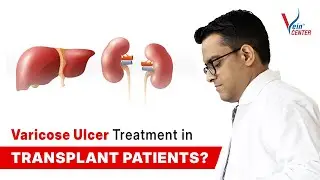 Varicose Ulcer Treatment for Organ Transplant Patients | The Vein Center