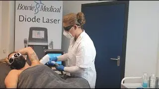 BOWIE DIODE LASER ICE+ presentatie