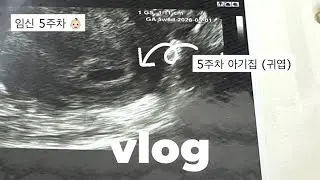 임신 5주차 증상. 아기집 확인 후 불안했던 시간. 초기 출혈. 산모애 샴푸&바디워시 후기. 초기 임산부 👶🏻