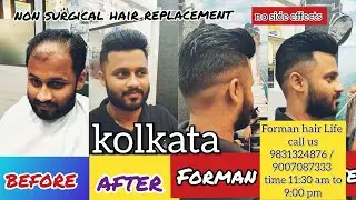 Forman Hair Life, Kolkata - Best Hair Patch Centre in Kolkata