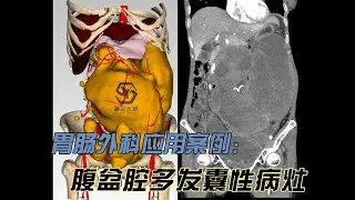 广西盛云三维科技有限公司 医学三维重建