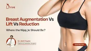 Why Breasts Can&rsquo;t Be Lifted Above IMF | Breast Augmentation vs Lift vs Reduction