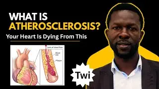 Do you know smoking, Hypertension, High LDL, High Sugar can cause these diseases. PURE TWI 