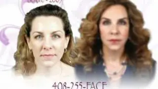 San Jose Facial Plastic Surgery Testimonial