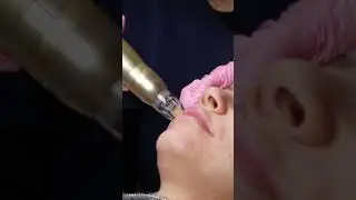 #foryou #fyp #beautytips #beautyhacks #beautycare #sylfirm #skintreatment #skintightening #melasma