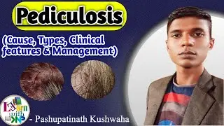 Pediculosis | Treatment of pediculosis | Louse | Lice infestation | Skin disease | #pediculosis