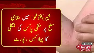 First case of local transmission of monkeypox reported in Khyber Pakhtunkhwa