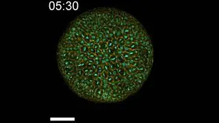 Patiria miniata wild type embryo