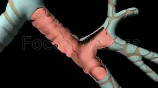 COPD - Animated Atlas