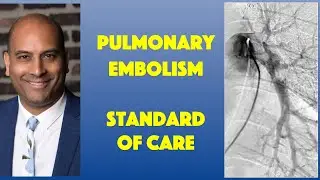PE: Standard of Care