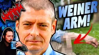 The Men With Penises Growing on Their Arms - Tales From the Internet