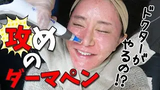 【お得感】医者がダーマペンをやるとギリギリに攻めまくるやん。