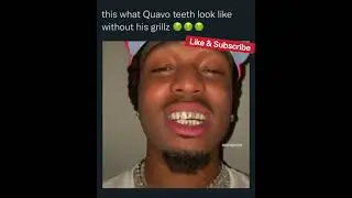 Quavo Show&rsquo;s His Teeth Without Grillz