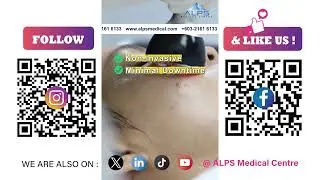 Application of RF