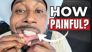 Was Dental Implant Surgery Pain Worth It? My Honest Experience