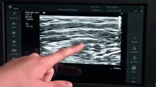 Xperius&reg; Ultrasound System &ndash; Advanced Technology