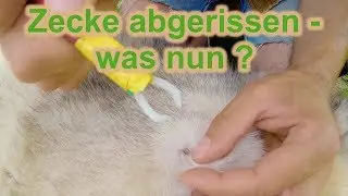 Zecken richtig entfernen / Was passiert, wenn ein Teil im Körper bleibt ? / Zecken-Doku