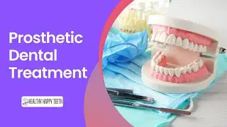 What is Prosthetic Teeth Treatment | Dental Prosthesis