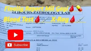 Finally Report Mil Gayi🩸💊 Blood Test🩸💉 X-Ray🩸💉 