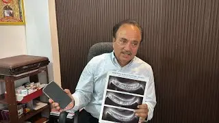 Dry Eyes & Vision Loss in Kids | Dr. Mahajan Explains Mobile Screen Dangers&rdquo;