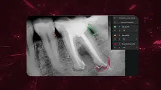 MyRay ProXIma X6 &ndash; the future of dental imaging, powered by Neowise