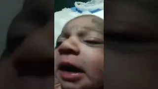 Baby Syringe Feeding    ll    Nicu Adorable Baby Feeding Video   ll   #babyfeeding #youtubeshorts