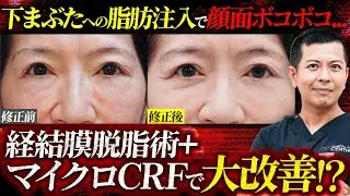 【危険】クマ治療と称して下まぶたに